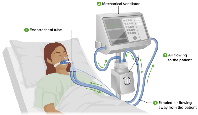 Medical Ventilator Dealer on rent in Dwarka